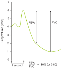 Fev1 Fvc Kaplan Respiratory Chart Diagram Line Chart