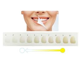 Us 23 09 30 Off 16 Colors Professional Paper Teeth Tooth Whitening Shade Guide Chart For Home Use Dental Supplie On Aliexpress