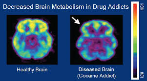 Individuals may claim they're addicted to tv, shopping or video games. Addiction Wikipedia