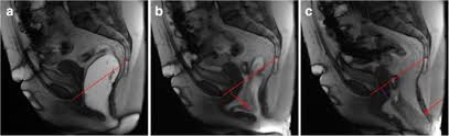 dynamic magnetic resonance imaging of