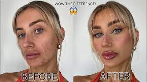 makeup base routine for bad skin