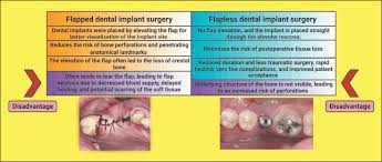 flapless surgical implant procedure