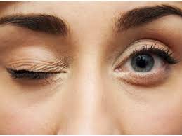eye twitch causes and treatment