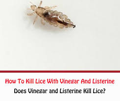 lice with vinegar and listerine