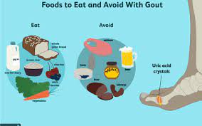 gout t best foods to eat and what