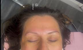 melbourne cosmetic procedures deals