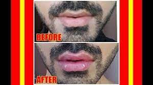 diy natural lip plumping