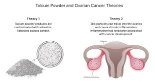 tal powder cancer risks types