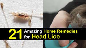 21 natural remes for head lice