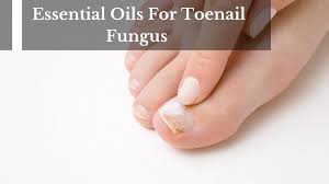 treat toenail fungus with essential oils