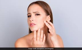 Best vitamin c supplement for skin in india. Bless Your Skin With The Goodness Of Vitamin C And E Here S How You Can Combine These Two For Flawless Skin