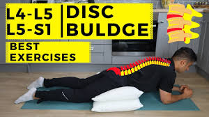 l4 l5 l5 s1 disc bulge best exercise