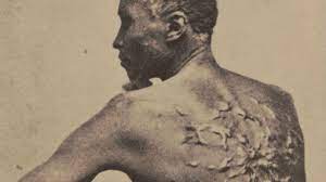 The Shocking Photo of 'Whipped Peter' That Made Slavery's Brutality  Impossible to Deny - HISTORY