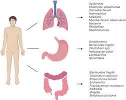 the s microbiome and cancer a