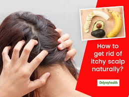 how to get rid of itchy scalp naturally