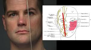 nerve blocks of the face and mouth