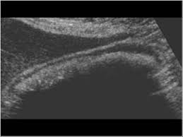    best Ultrasound Abdomen images on Pinterest   Nursing schools     Diagnostic Imaging