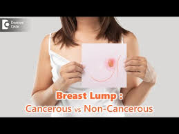 t lumps cancerous vs non cancerous