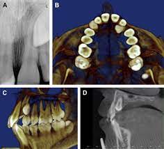 cone beam ct s in