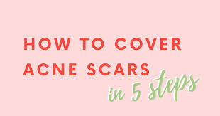 how to cover acne scars in 5 steps