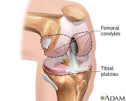 knee joint replacement information