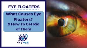 eye floaters what causes eye floaters