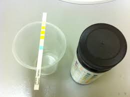 tests urinaires par bandelette urinaire