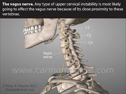The majority of these nerves control the functions of the upper extremities and allow you to feel your arms, shoulder, and back of your head. Tinnitus Cervical Spine Instability And Neck Pain Caring Medical Florida