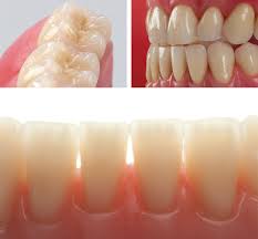 Stocked Denture Teeth Dental Lab Network