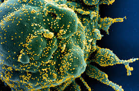 Fotos: Los virus más infecciosos del último siglo, en imágenes | Ciencia |  EL PAÍS