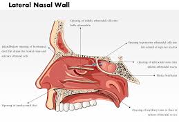 0514 lateral nasal wall cal images