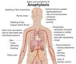 Here, learn to recognize the symptoms and what to do next. Anaphylaxis Dr Caterina Detoraki Zerodonto