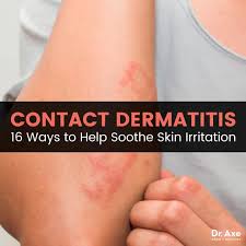 contact dermais causes natural