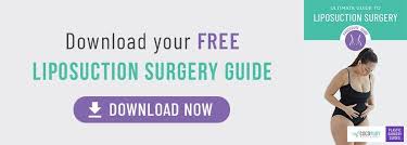 liposuction faqs questions and