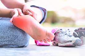 staying active with plantar fasciitis