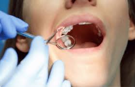 wisdom tooth extraction