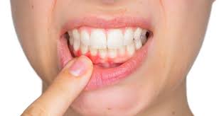 Why Do I Have Gum Pain? | Boyett Family Dentistry