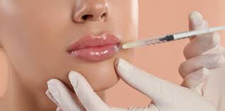 best lip filler injections in west