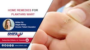 home remes for plantar warts