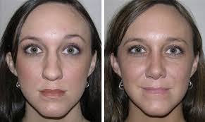 We did not find results for: A New Nose For The New Year Birmingham Plastic Surgery Specialists