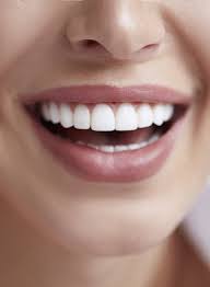 veneers rockwall fix cosmetic dental