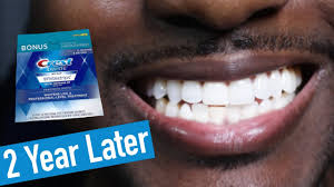 Don't overuse the strips, or you might end up damaging and demineralizing your teeth. Teeth Whitening Strips The Best Strips For A Whiter Smile