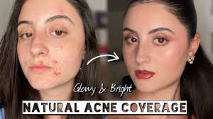 the ultimate glowy natural acne