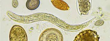 Bandwürmer können als parasiten auch den menschen befallen und durchaus schwerwiegende symptome hervorrufen. Madenwurmer Loswerden Hausmittel Gegen Wurmer Im Stuhl Herold