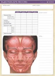 Image Result For Botox Injection Sites Chart Botox