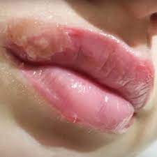 lip tattoo infection why it can