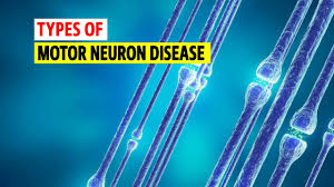 types of motor neuron disease you
