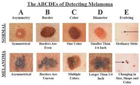 The Skin Cancer Detector That Could Save Your Life