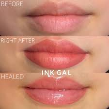 5 effective alternatives to lip fillers