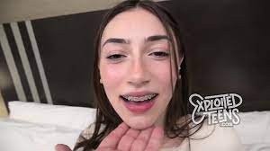 Watch this 18 yr old with braces give a sloppy blowjob - XVIDEOS.COM